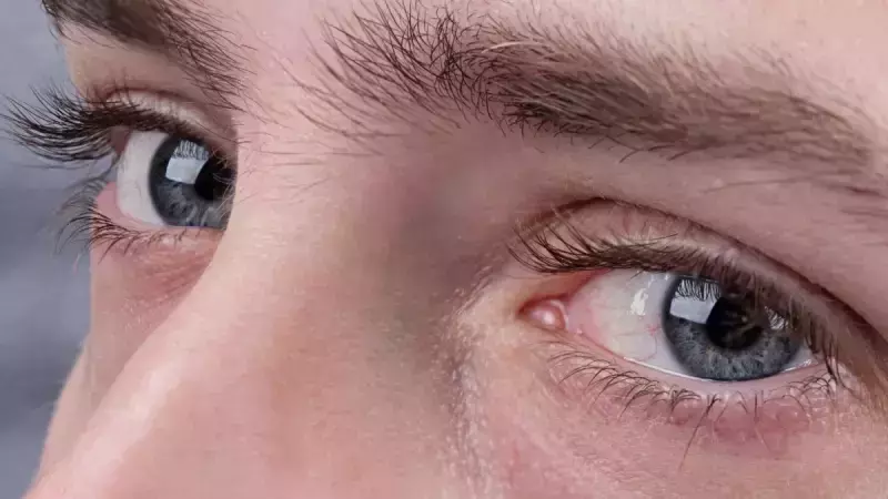 Grey Eyes is one of the World's Rarest Eye Colors